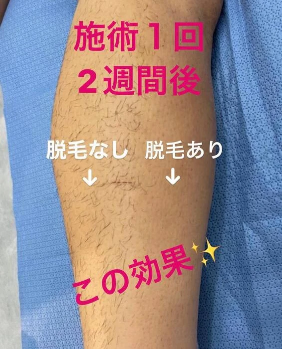 画像349